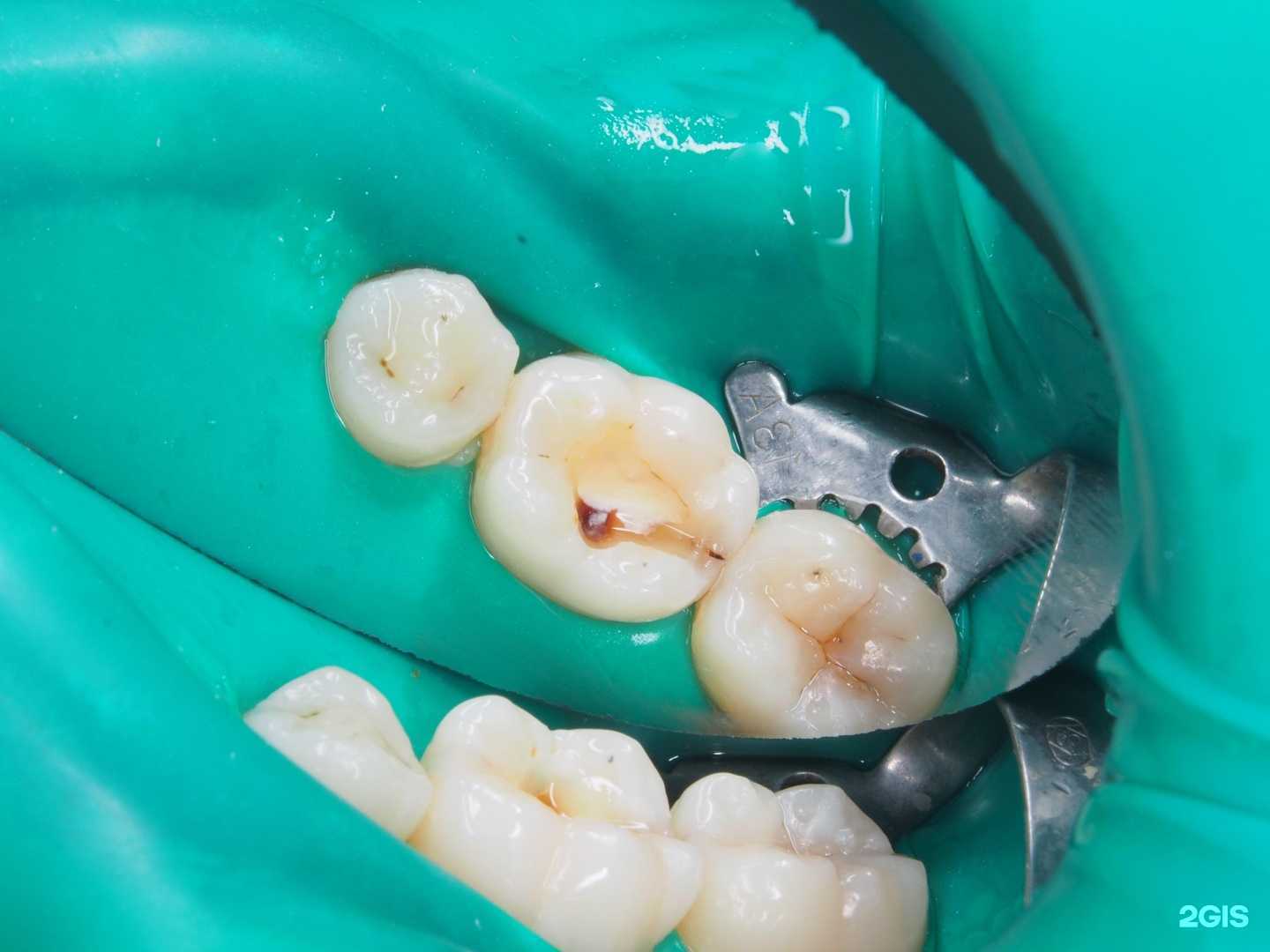 Отзывы на компанию Статус Стоматология в Воронеже c фото