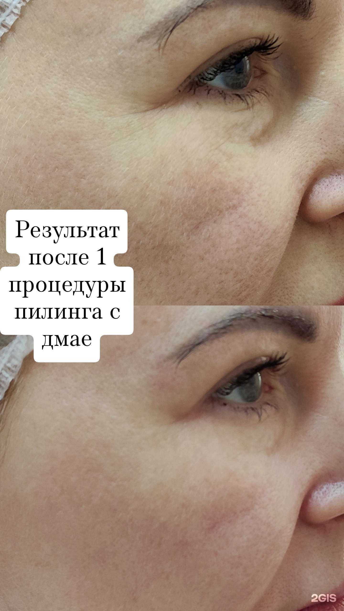 Отзывы на компанию An Li в Тюмени c фото