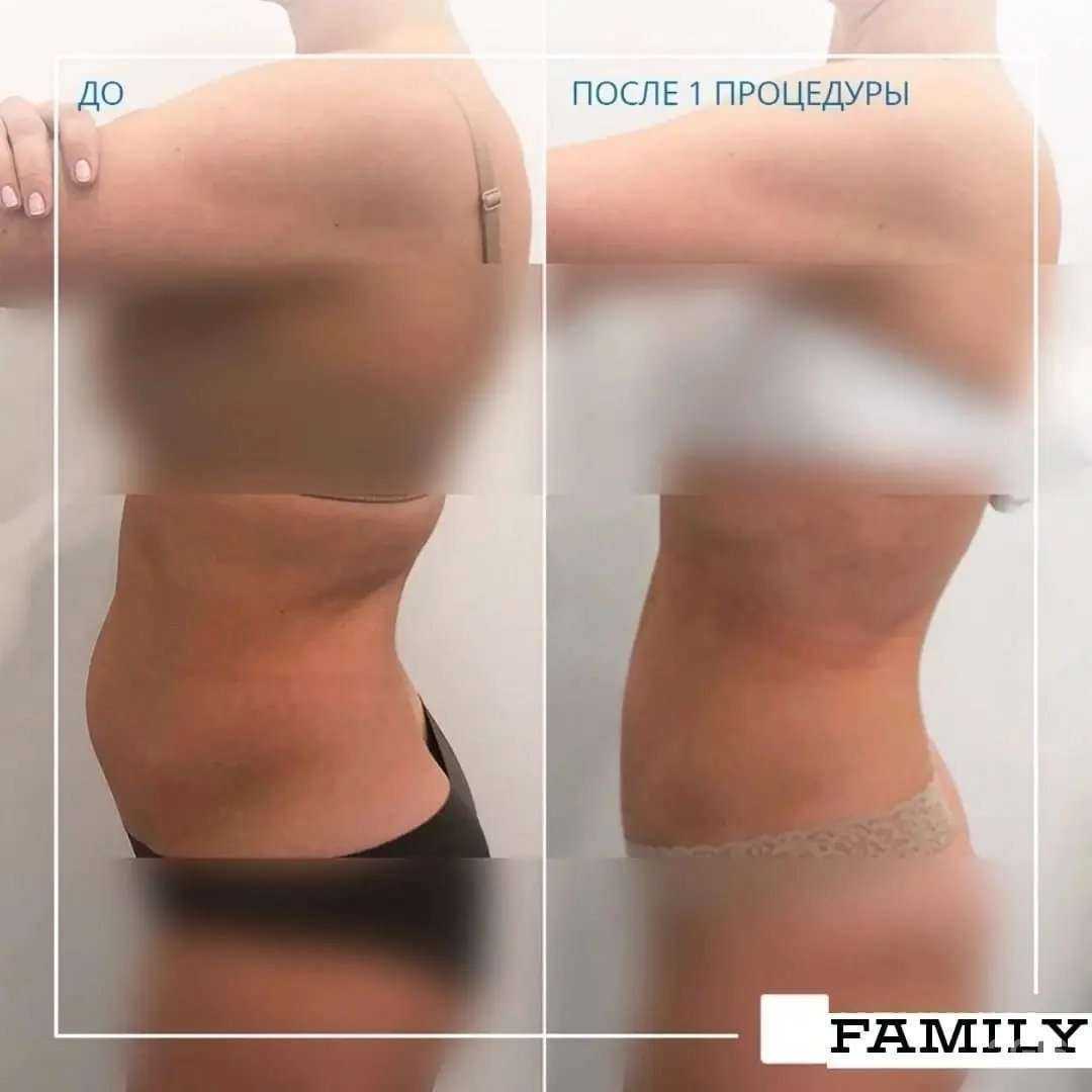 Отзывы на компанию Care family в г. Воткинск c фото